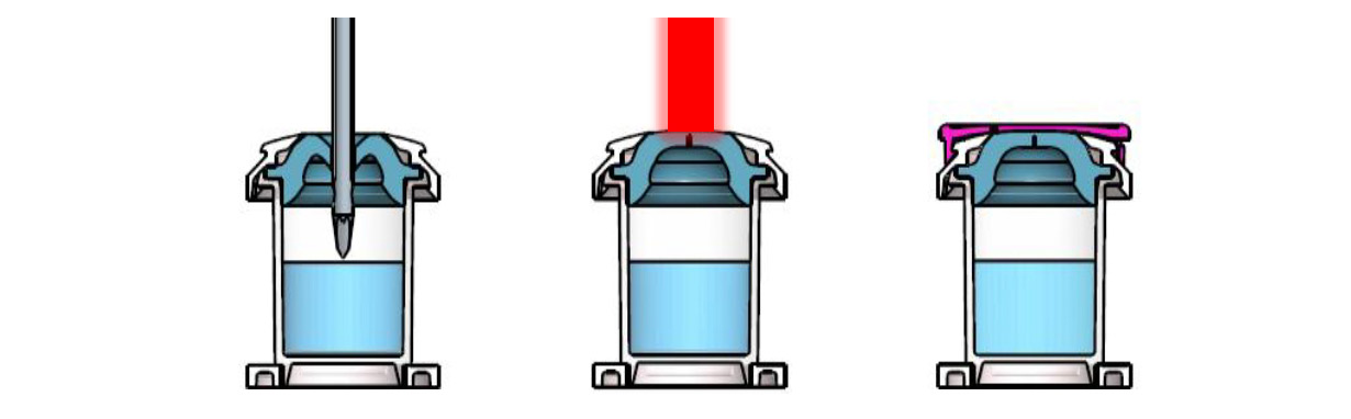 3 process steps: filling, laser re-sealing, capping